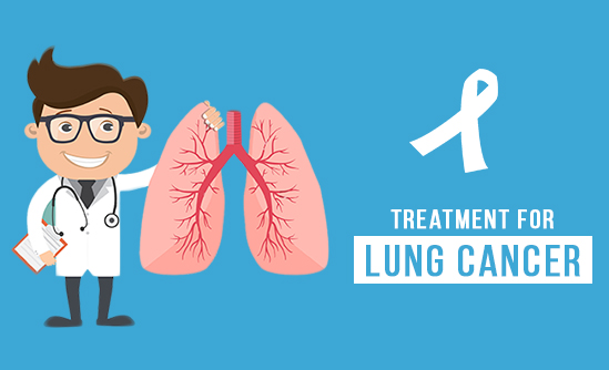 Treatment for Lung Cancer
